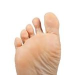 Foot infections